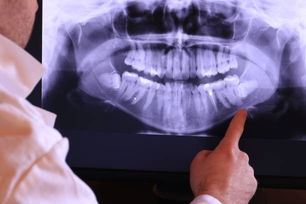 Best Emergency Dentist for Lost Fillings or Crowns in Palmetto Bay, FL